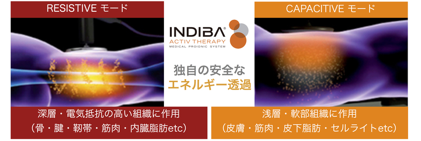 INDIBA インディバキャパエレクトロード25ミリ幅 丸軸 INDIBA