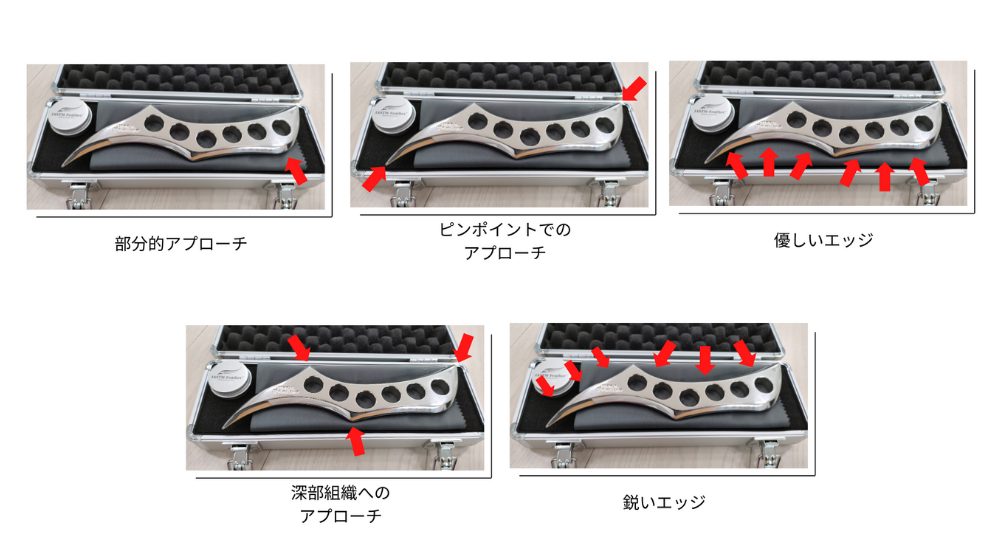 ISATM-筋膜リリースとは？ | 【IASTM筋膜リリース認定資格セミナー