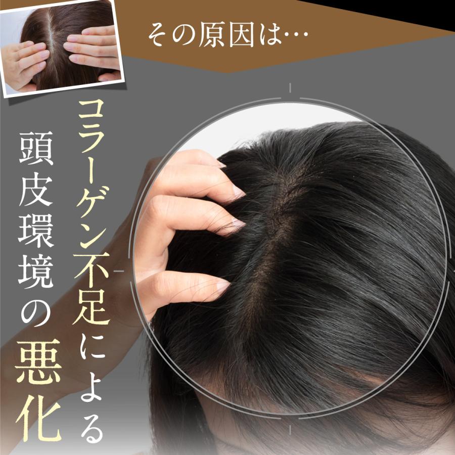 シャンプー 詰め替え パウチ【公式】 ノ・アルフレ あすなろわかさ