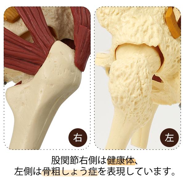 7ウェルネ 脊椎模型 人体模型 ( 主要筋 靭帯 神経 血管 付 ) 実物大