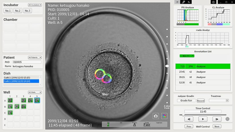 中村先生に聞いてみよう！ 不妊治療の最前線 ― タイムラプス