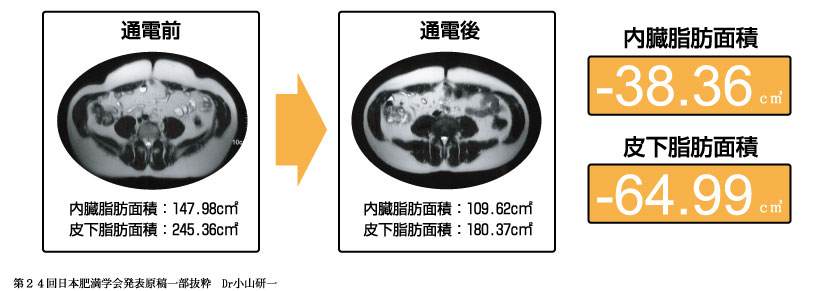 プロテクノPNF | 日本シーエイチシー株式会社