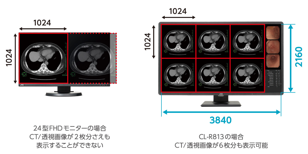 800万画素32型カラー液晶モニター JESRA X-0093(管理グレード1B)対応