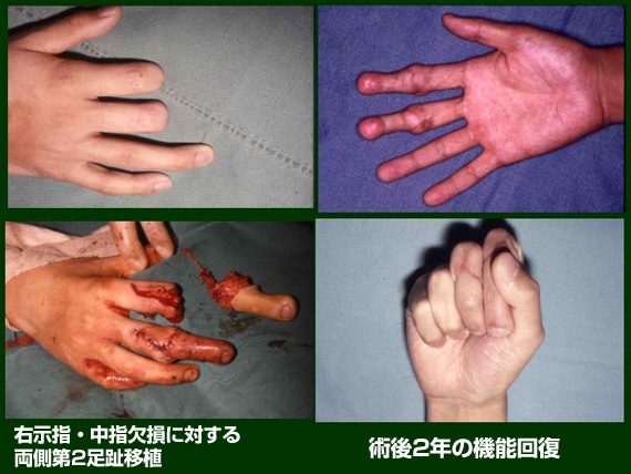 一般社団法人日本マイクロサージャリー学会