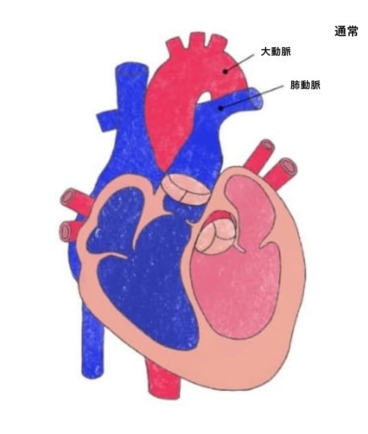 先天性心疾患｜順天堂医院 心臓血管外科