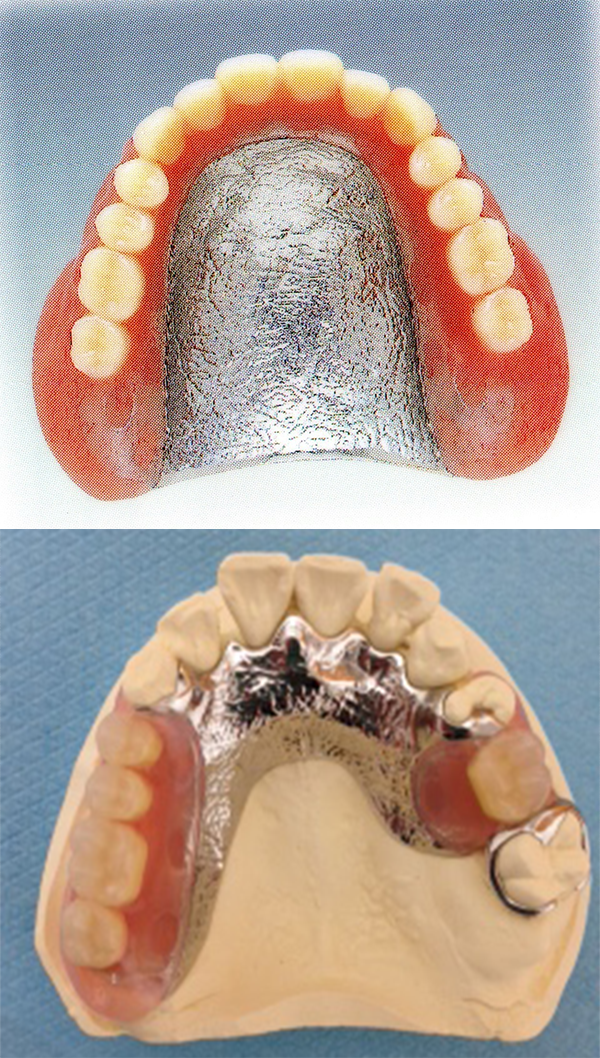 入れ歯 | 横川駅からすぐ | こばやし歯科医院 – 横川駅から徒歩1分、駐