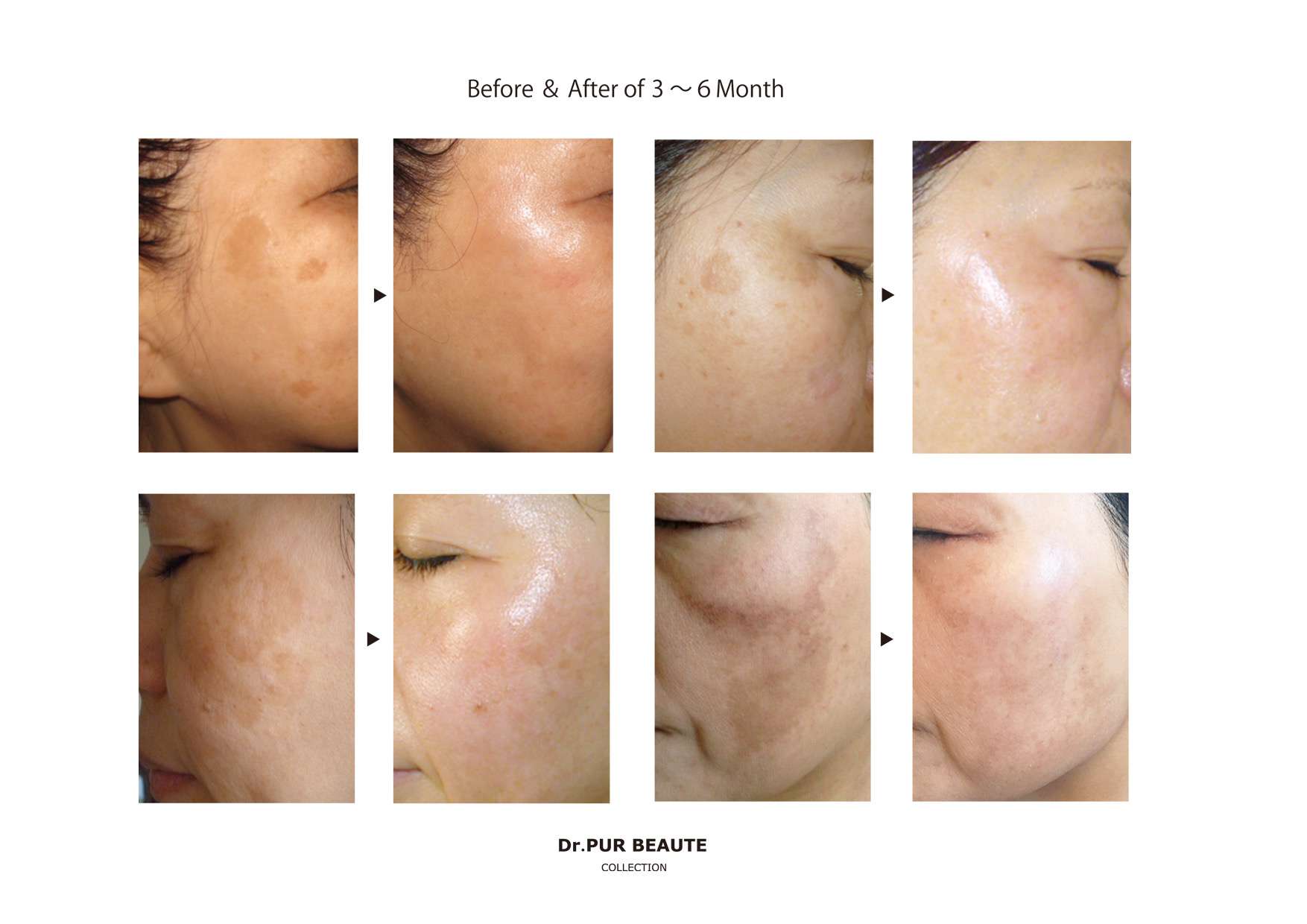 Before・After 特集