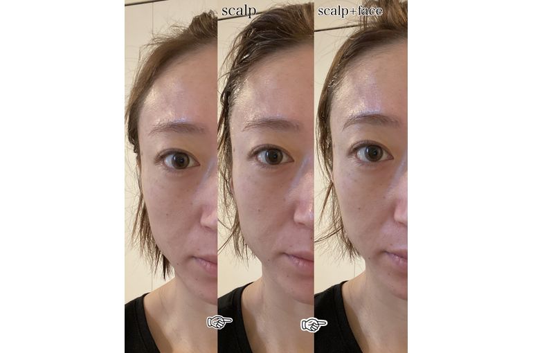 大阪 リアボーテ】リアボーテ美顔器 効果