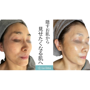 大阪 リアボーテ】クレアスキンのクリスマスコフレ ご紹介