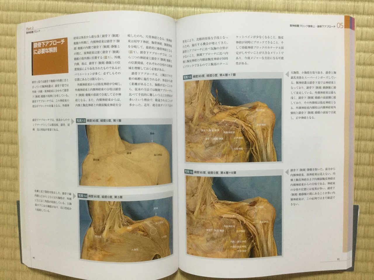 末梢神経マニピュレーション Amazon.co.jp: 末梢神経マニピュレ-ション