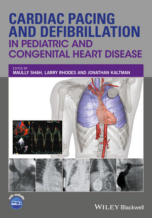 Surgery for Congenital Heart Defects, 3rd Edition | Wiley