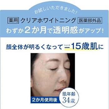 Amazon | ヴァーナル 薬用 クリアホワイトニング 100mL 美白化粧水