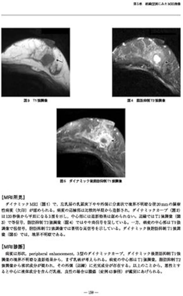 臨床と病理のための乳腺MRIアトラス | 眞一, 土屋, 達夫, 隈崎, 律