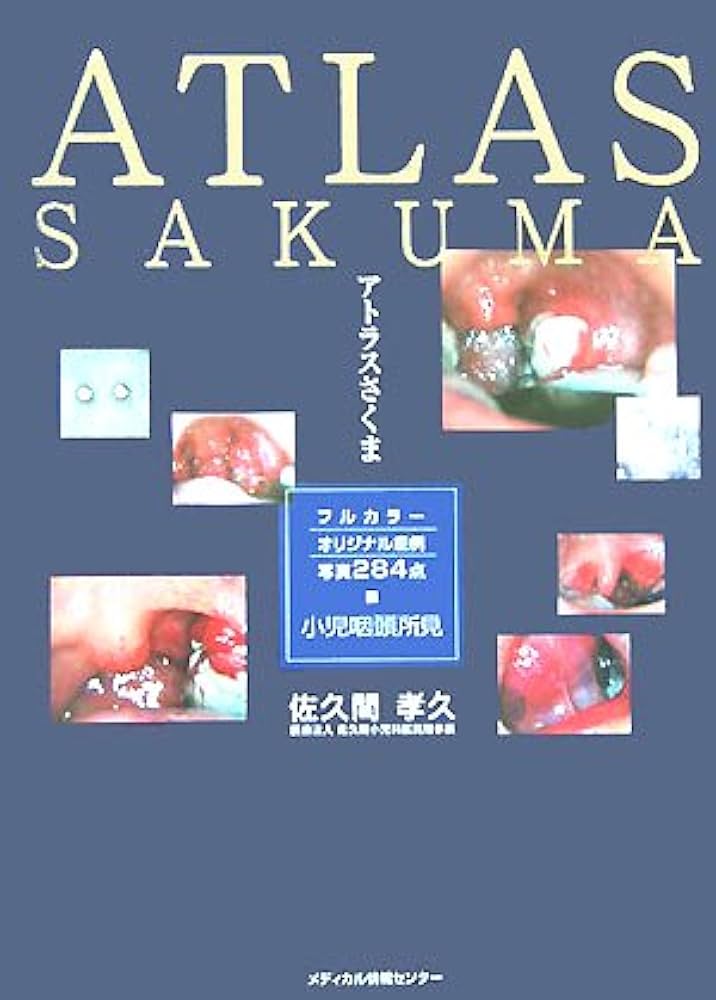 アトラスさくま―小児咽頭所見 | 佐久間 孝久 |本 | 通販 | Amazon