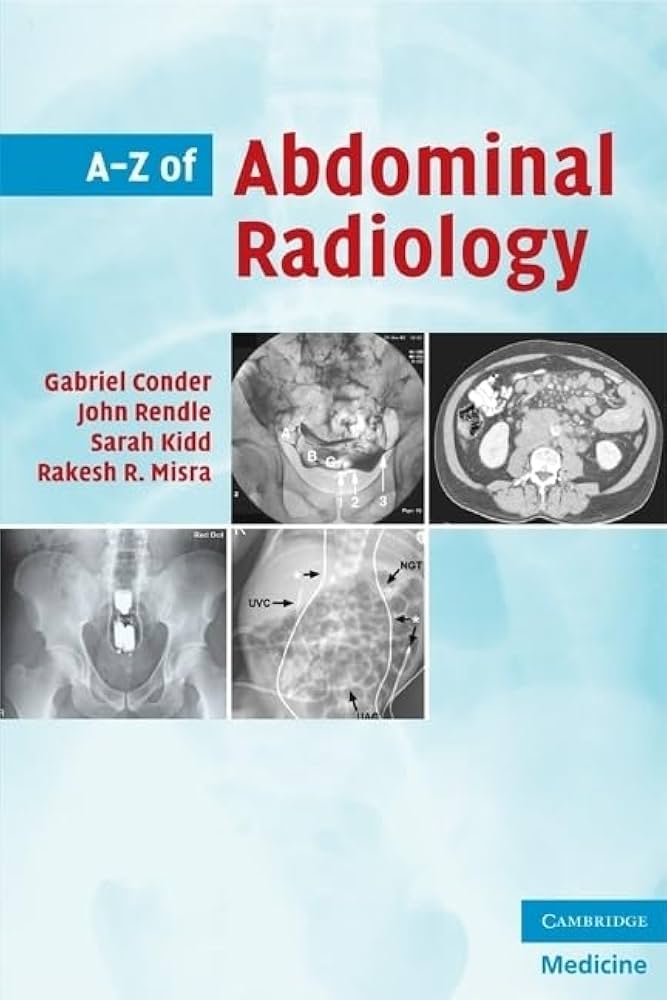 A-Z of Abdominal Radiology: 9780521700146: Medicine & Health