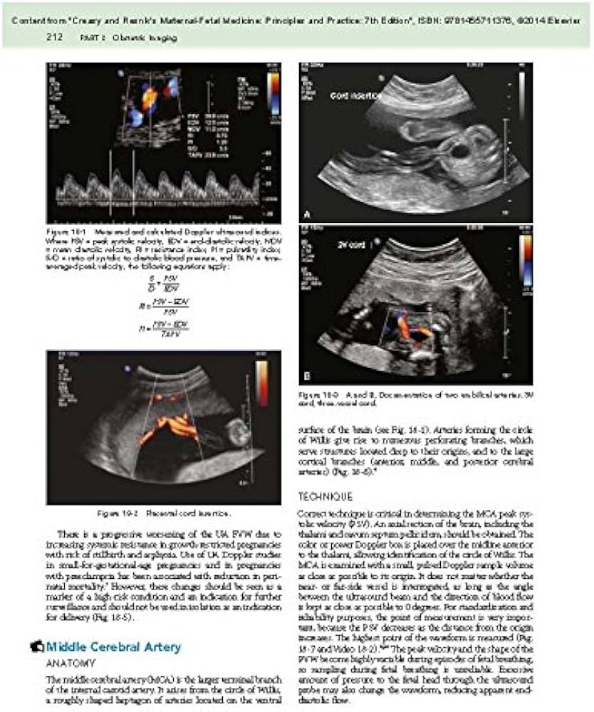 51+SW6Ftx7L._AC_UF1000,