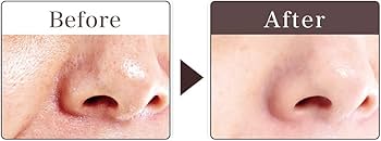 Amazon.co.jp: 毛穴凸凹小じわカバー化粧下地 (毛穴隠し) ピンクレス