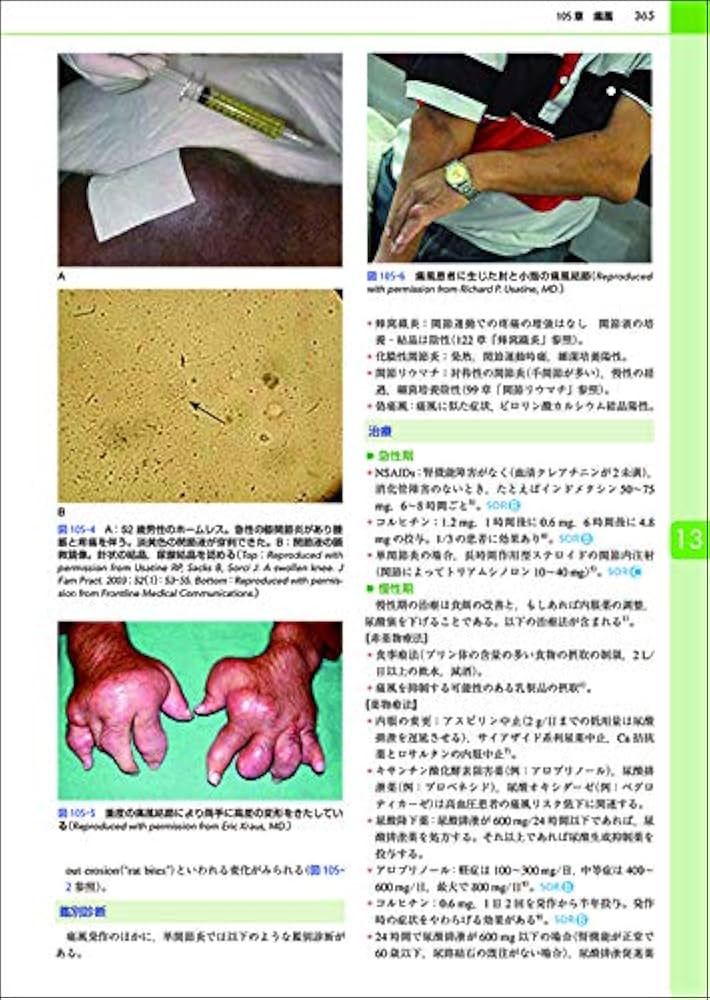 カラー版 国際診療のための内科アトラス大事典 | リチャード・P・ユー