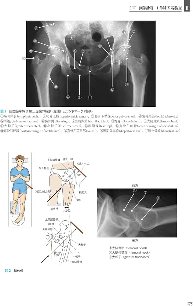 Amazon.co.jp: 股関節学 第2版 : 一般社団法人 日本股関節学会, 菅野