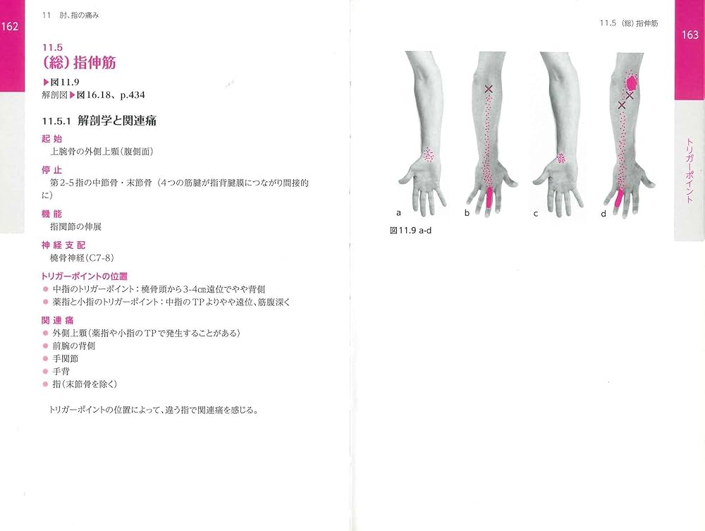 筋筋膜トリガーポイント ポケットアトラス: トリガーポイントによる