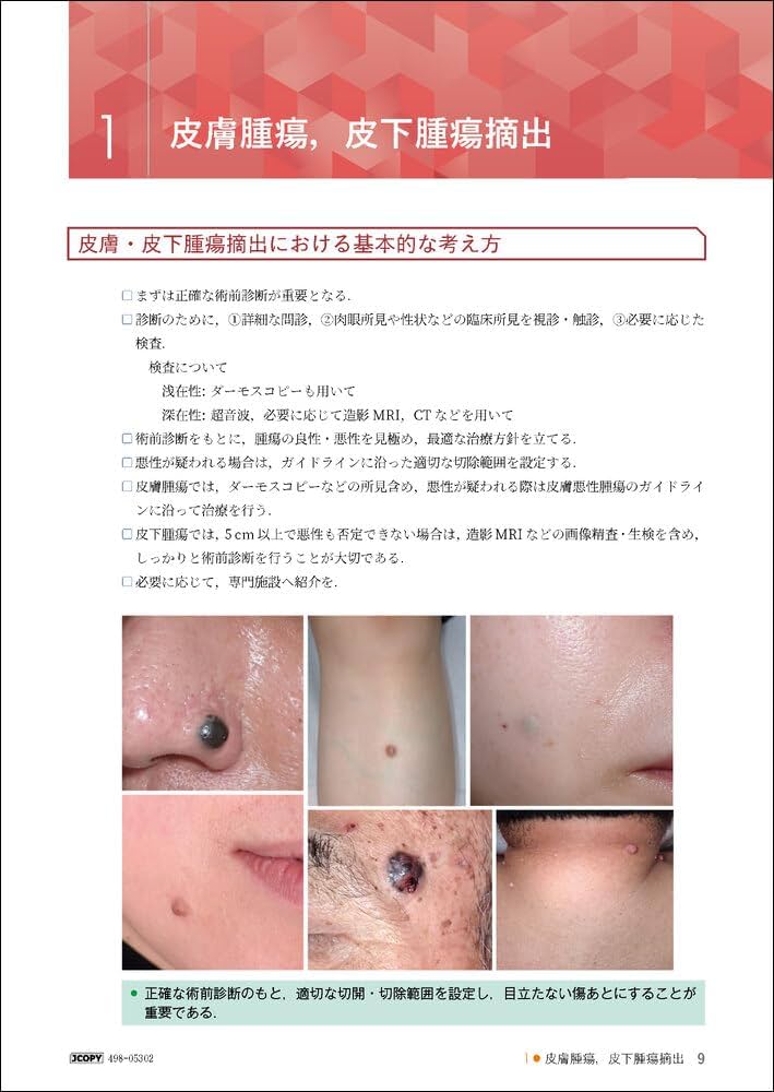 61z1+jxZmgL._AC_UF1000,