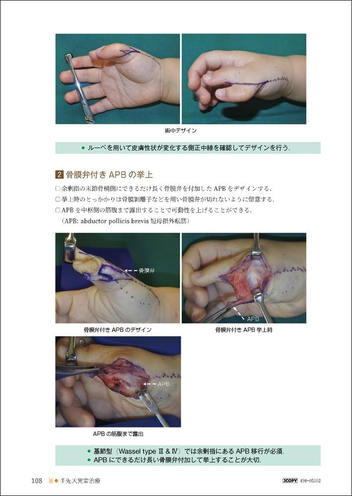 アトラス形成外科手術－見てわかるエキスパートのテクニック－ | 小川