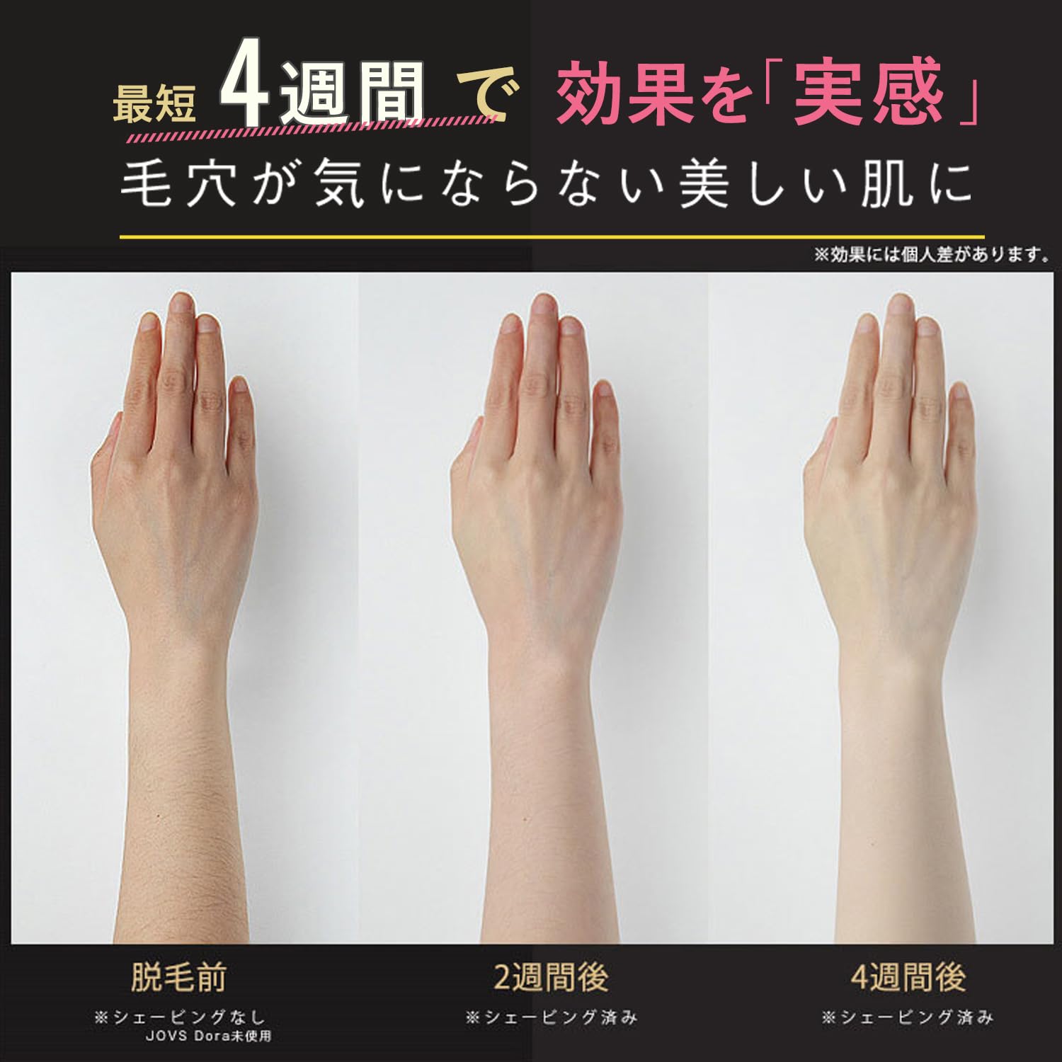 Amazon | JOVS Dora SRモード搭載 2024年型 脱毛器 家庭用 メンズ髭