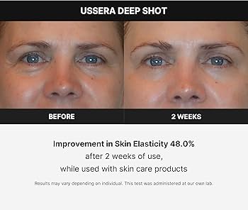 Medicube Age-R USSERA Facial Treatment Device - at-Home Skin Care