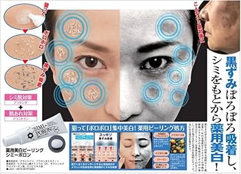 Amazon.co.jp: 薬用シミーポロン 30g 医薬部外品 シミ取りクリーム