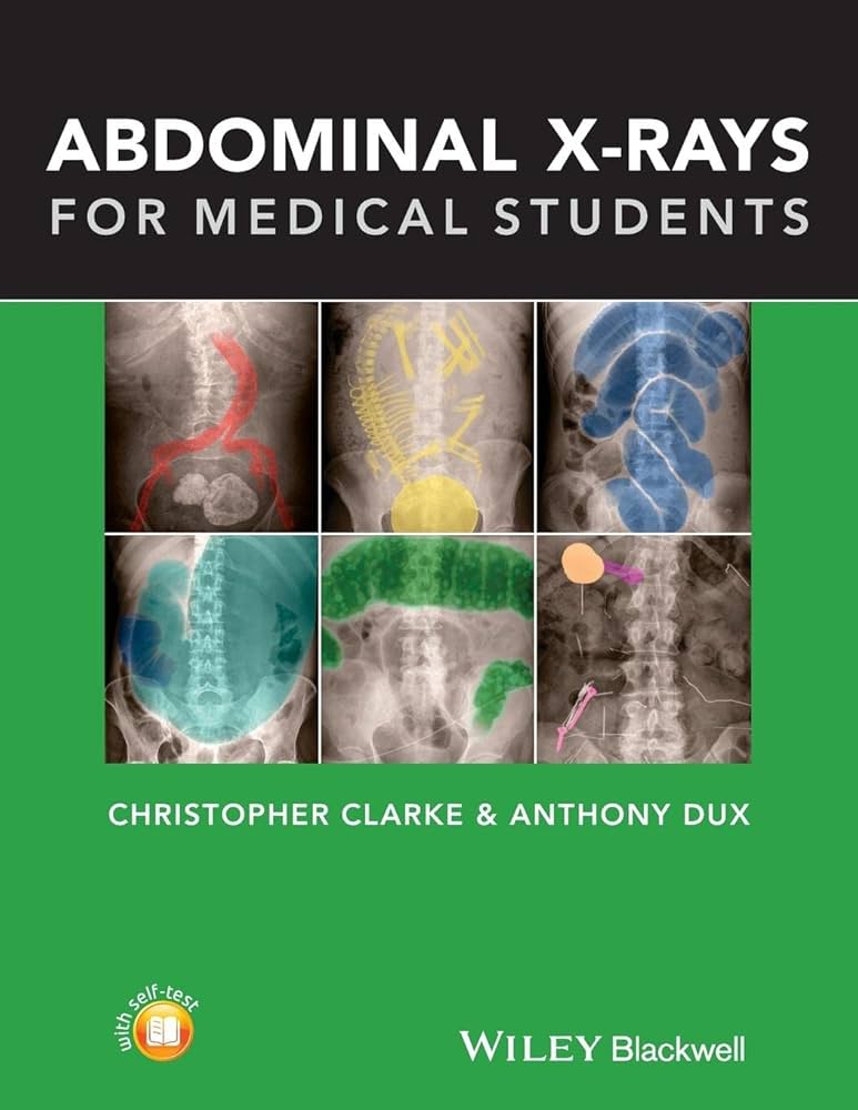 Abdominal X-rays for Medical Students: 9781118600559: Medicine