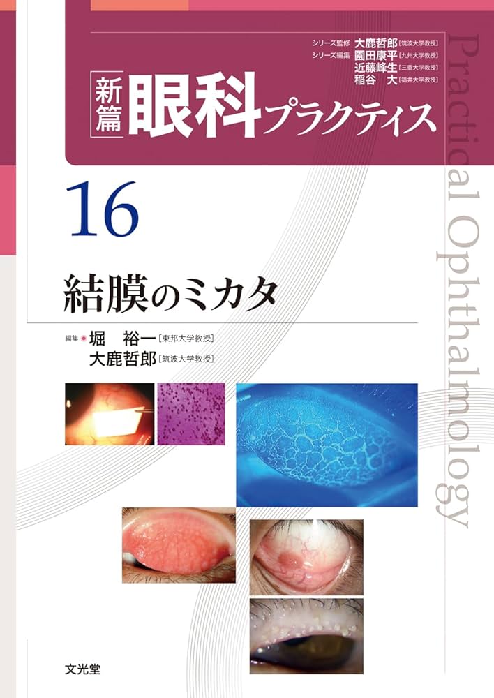 結膜のミカタ (新篇眼科プラクティス 16) | 堀 裕一, 大鹿哲郎 |本