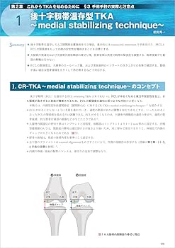 TKA・UKA 人工膝関節置換術パーフェクト〜人工膝関節全置換術・人工膝