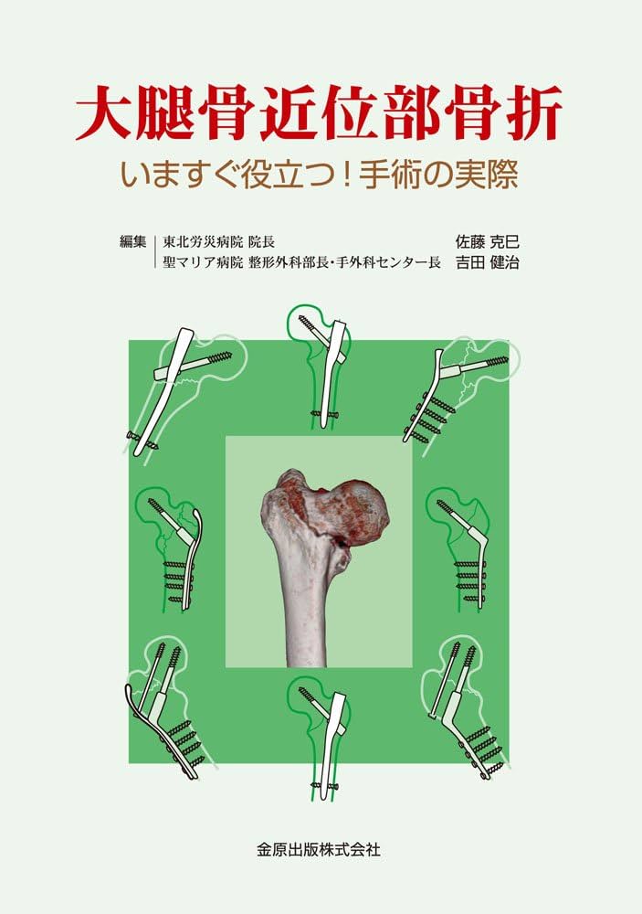 大腿骨近位部骨折: いますぐ役立つ! 手術の実際 | 佐藤克巳, 吉田健治