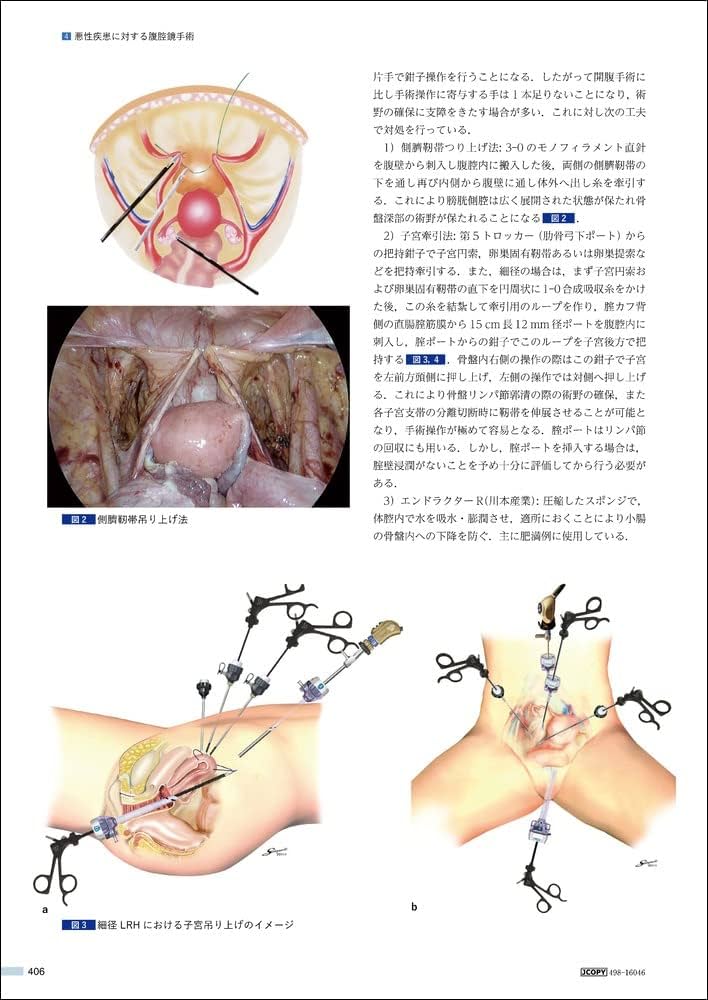 婦人科腹腔鏡手術学 The Kurashiki Method | 安藤 正明, 菅野 潔 |本