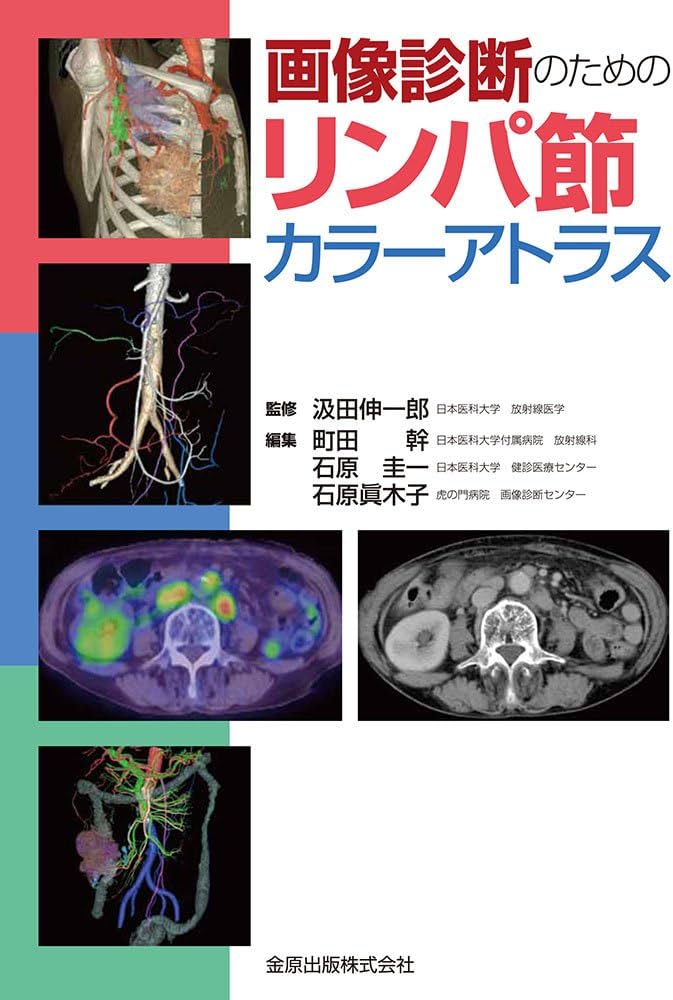 画像診断のためのリンパ節カラーアトラス | 汲田 伸一郎 |本 | 通販