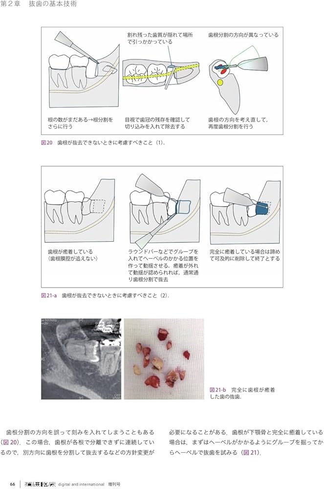 補綴臨床 digital and international」増刊号 第58巻2号 これ一冊で