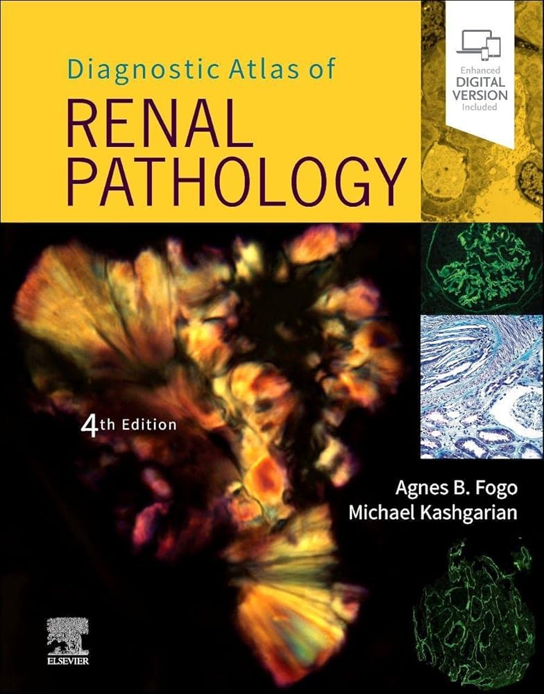 Diagnostic Atlas of Renal Pathology: 9780323721639: Medicine