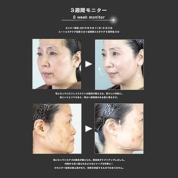 Amazon.co.jp: ZOGANKIN HYPER(ゾーガンキン・ハイパー) 3種の高周波