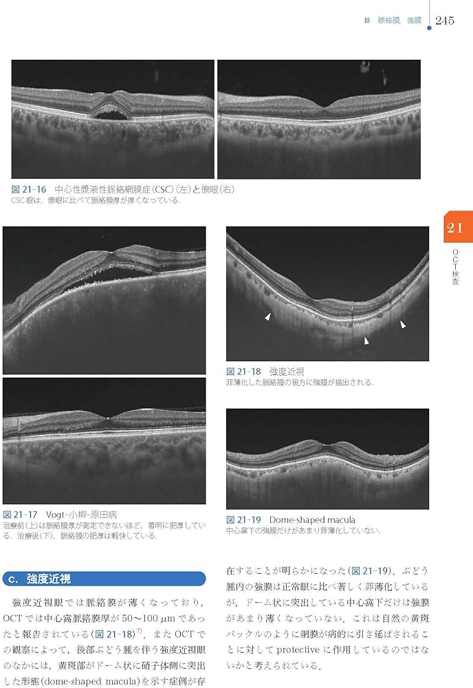 Amazon.co.jp: 視能検査学 (視能学エキスパート) : 公益社団法人 日本