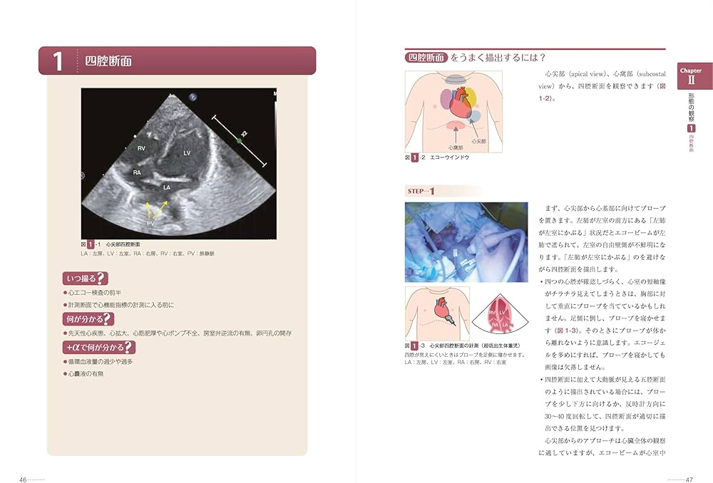 711C-WJaIAL._AC_UF1000,