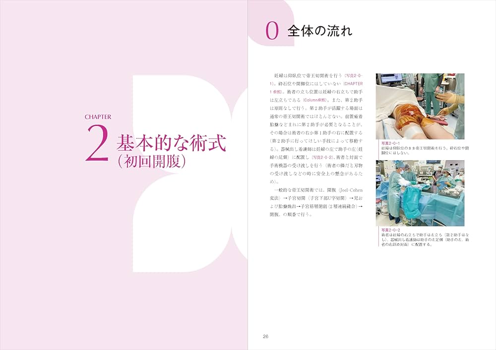 エキスパートこだわりの帝王切開術：理論＋根拠を押さえてコツを得る