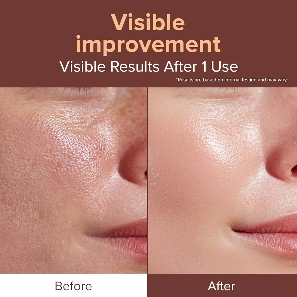 Amazon.com: idplacosmetics EXO-V Booster Ampoule 1.01 fl.oz (30ml