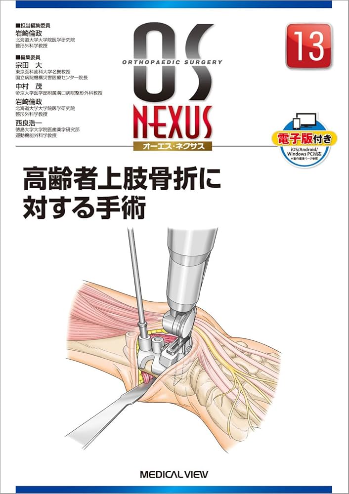 高齢者上肢骨折に対する手術 (OS NEXUS(電子版付き) 13) | 岩崎 倫政