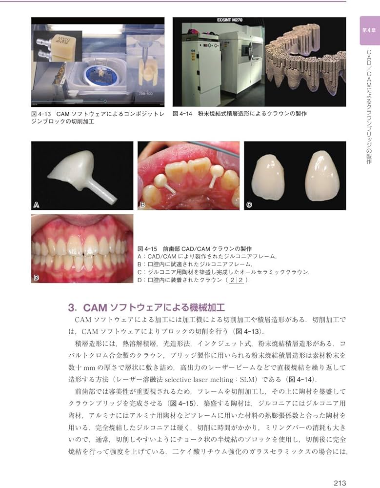 クラウンブリッジ補綴学第6版 | 矢谷 博文, 三浦 宏之, 細川 隆司