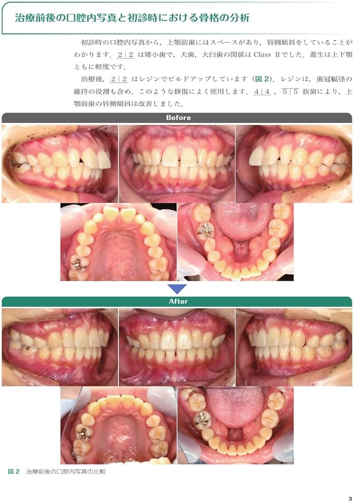 実践的リンガルブラケット矯正 | 松野 功 |本 | 通販 | Amazon