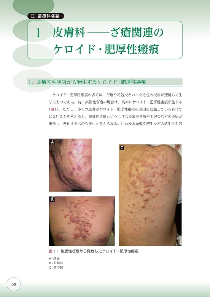 Amazon.co.jp: ここまでできる ケロイド・肥厚性瘢痕の予防と治療