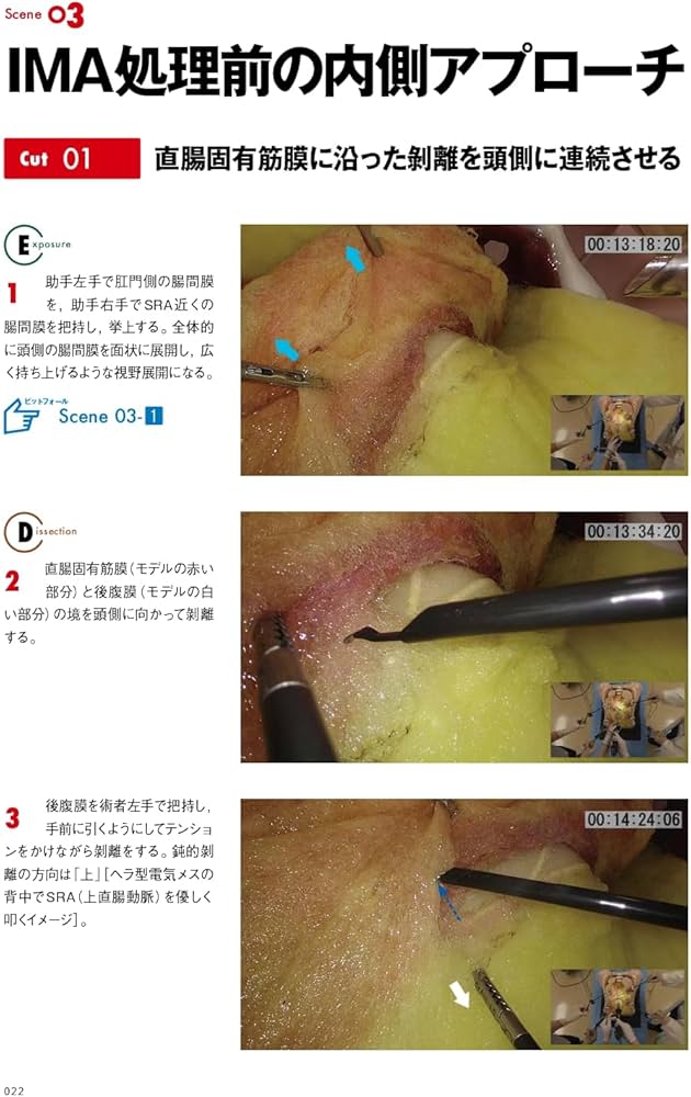 腹腔鏡下S状結腸切除術ハンズオントレーニング[DVD付]: 動画でわかる