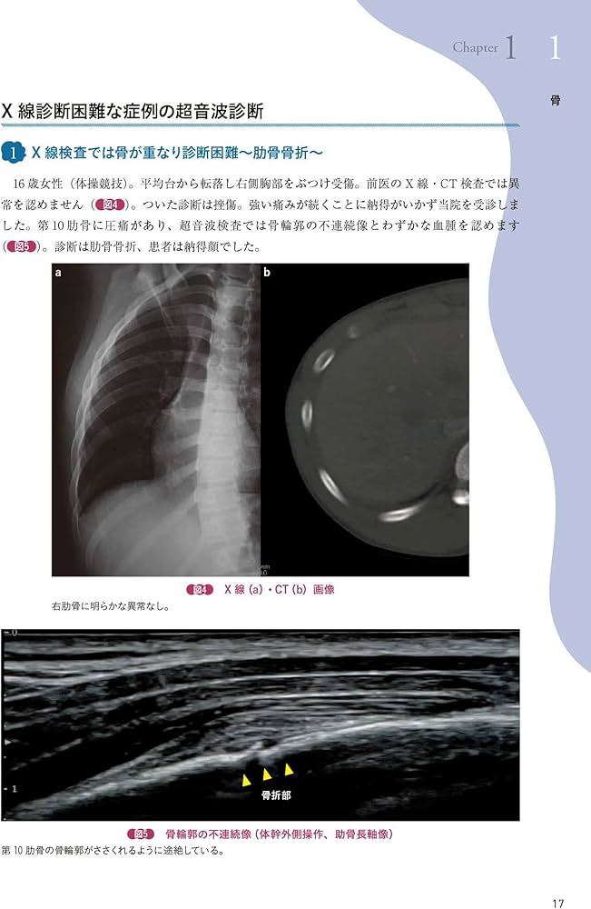 Amazon.co.jp: 運動器エコーのメタ診療: 実臨床に役立つAR動画100本