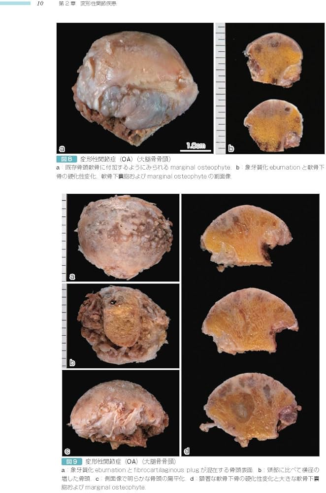 骨関節 (非腫瘍性疾患病理アトラス) | 石田 剛, 今村哲夫 |本 | 通販