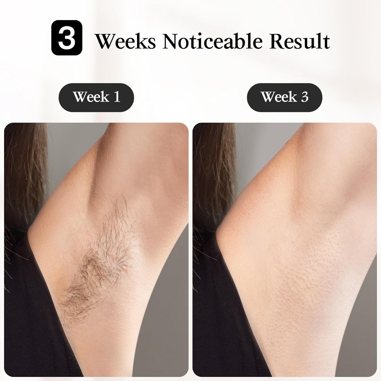 Amazon.com: JOVS Laser Hair Removal, [24J Energy] IPL Hair Removal